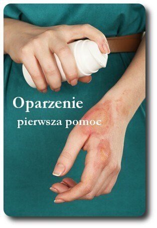 Oparzenie pierwsza pomoc przepis Olga Smile